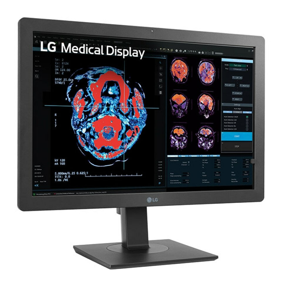 LG 24HR513C-B Monitor (24")