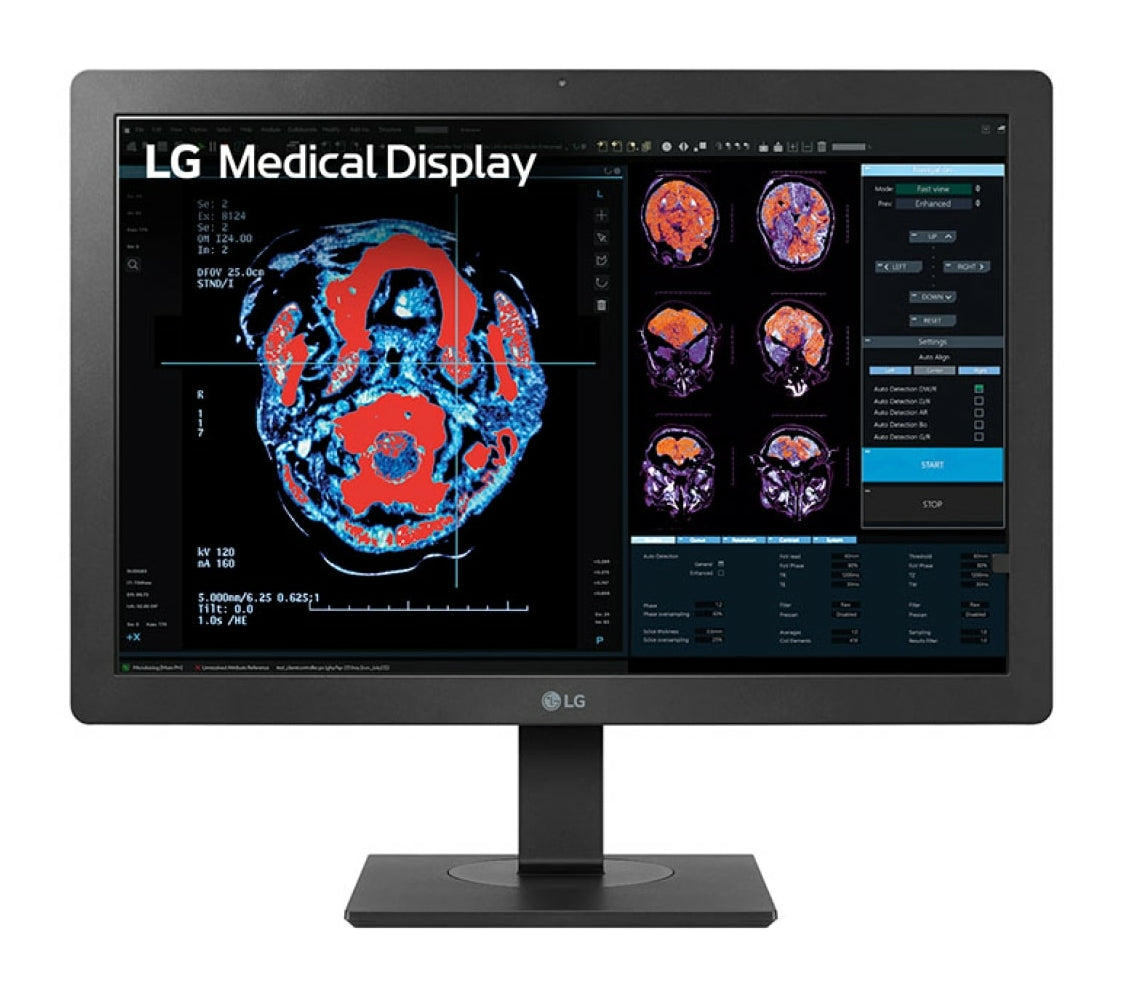 LG 24HR513C-B Monitor (24")
