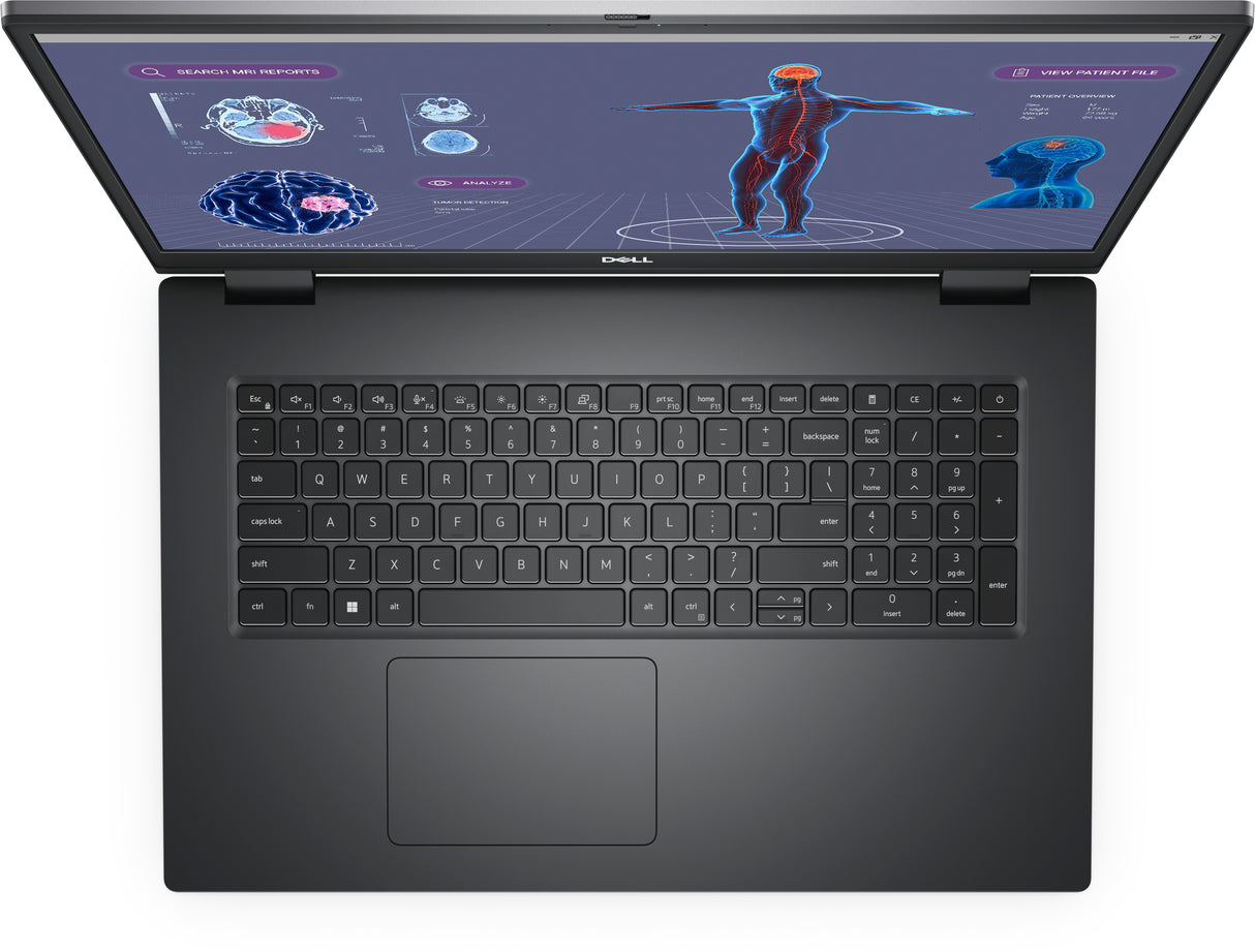 DELL Precision 7000 Laptop Core i7 (17.3") 32GB/512GB