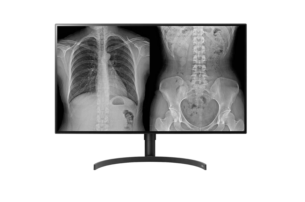 LG 32HL512D-B Monitor – 31.5" / 4K UHD / IPS / 60Hz – Business Monitor