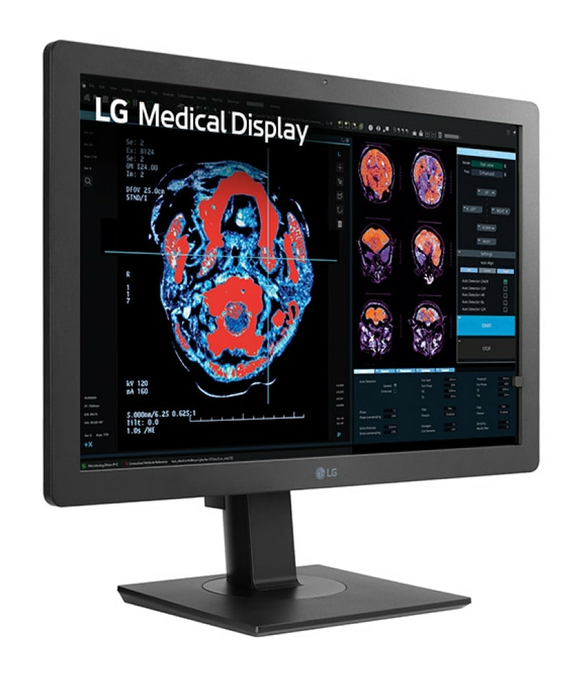 LG 24HR513C-B Monitor (24")