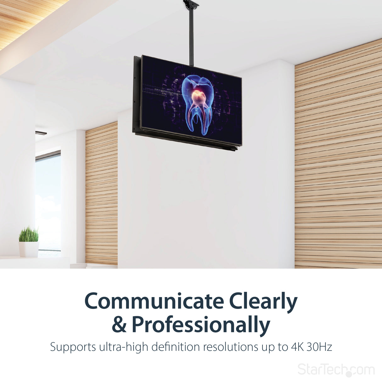 STARTECH 4K HDMI Splitter 1 In 2 Out - 4K 30Hz HDMI 1.4 2 Port Video Splitter Box -with high speed HDMI cable | USB power cable - Black (ST122HD4KU) (ST122HD4KU)