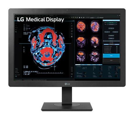 LG 24HR513C-B Monitor (24")