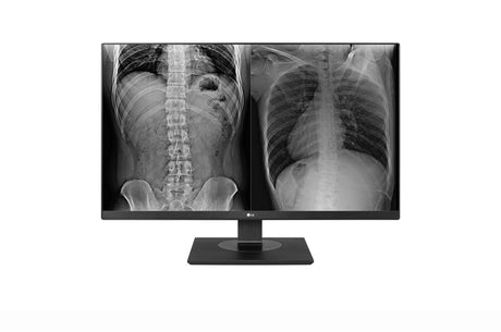 LG LED display (27") 4K Ultra HD Black