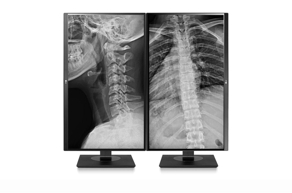 LG LED display (27") 4K Ultra HD Black