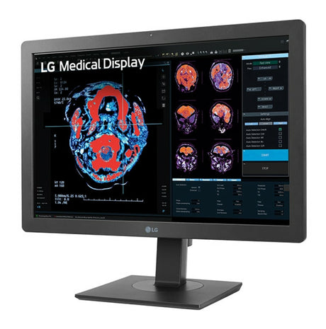 LG 24HR513C-B Monitor (24")